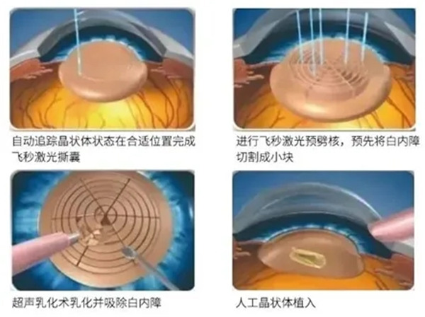 3.webp.jpg 3.webp.jpg