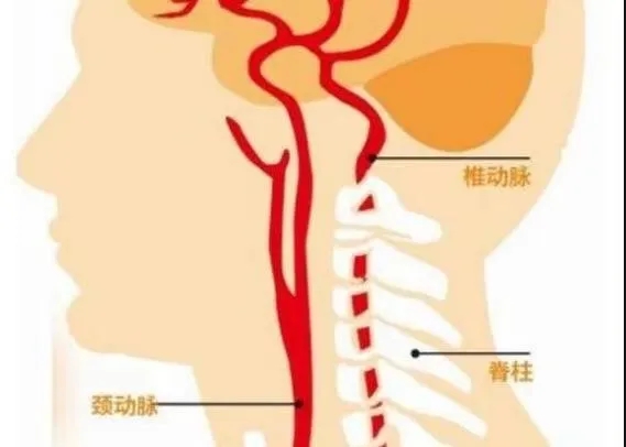 4.webp.jpg 4.webp.jpg