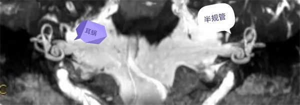 3.webp.jpg 3.webp.jpg