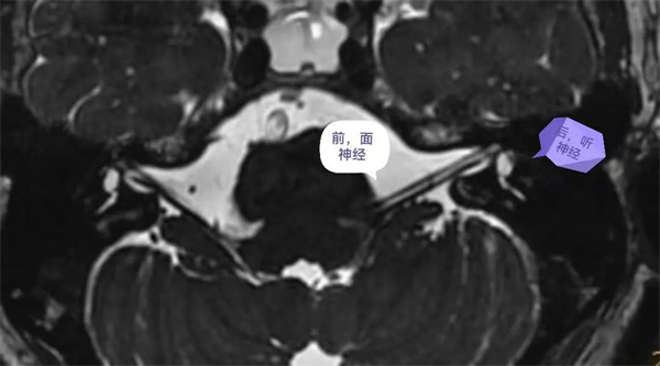 4.webp.jpg 4.webp.jpg