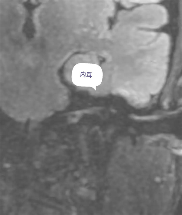 12.webp.jpg 12.webp.jpg