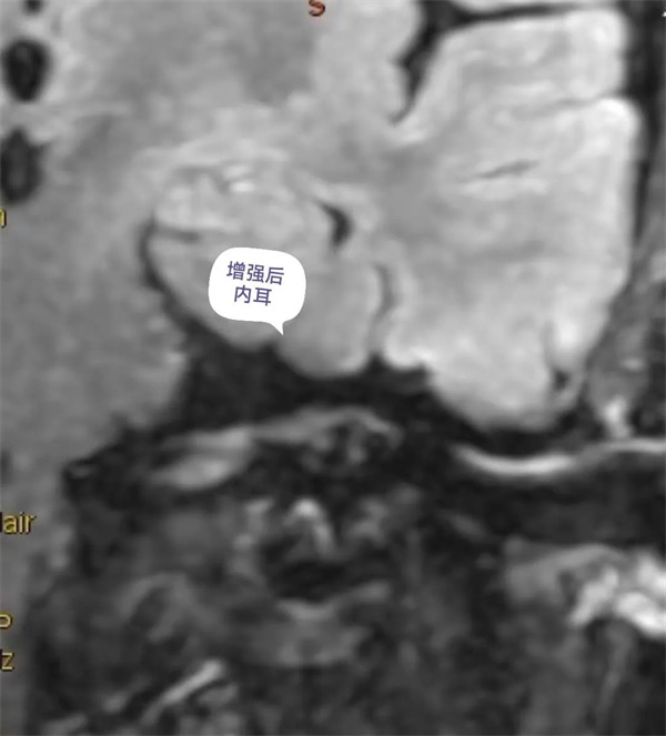 13.webp.jpg 13.webp.jpg