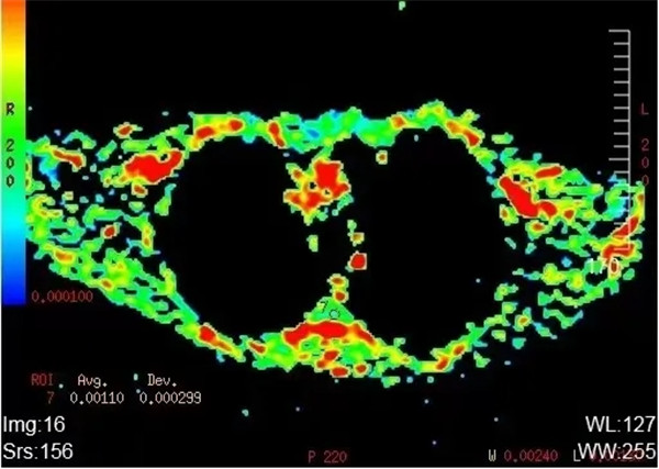 2.webp.jpg 2.webp.jpg