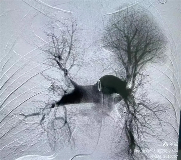 3.webp.jpg 3.webp.jpg