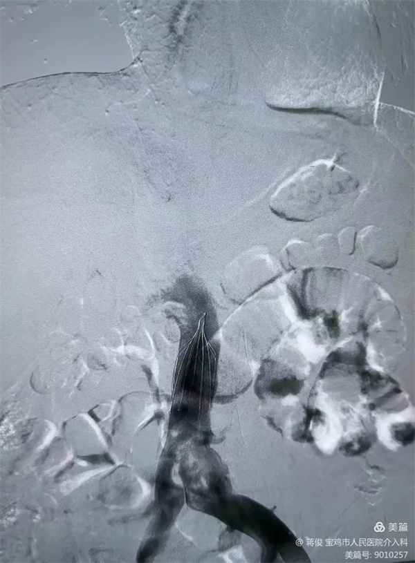 4.webp.jpg 4.webp.jpg