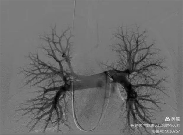 5.webp.jpg 5.webp.jpg