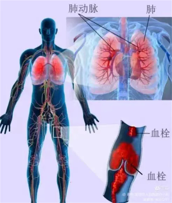 10.webp.jpg 10.webp.jpg