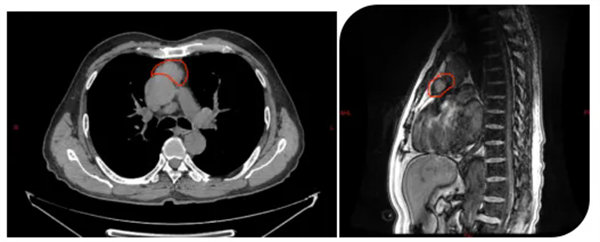 2.webp.jpg 2.webp.jpg