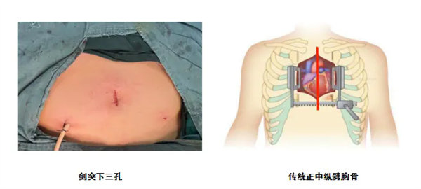 3.webp.jpg 3.webp.jpg