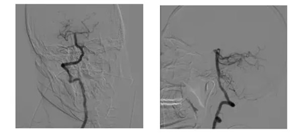 1.webp.jpg 1.webp.jpg