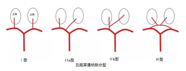 3.webp.jpg 3.webp.jpg