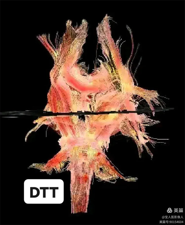 3.webp.jpg 3.webp.jpg