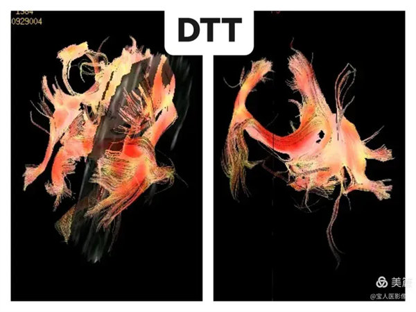 4.webp.jpg 4.webp.jpg