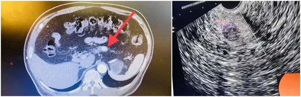 2.webp.jpg 2.webp.jpg