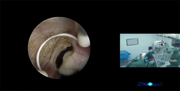 3.webp.jpg 3.webp.jpg